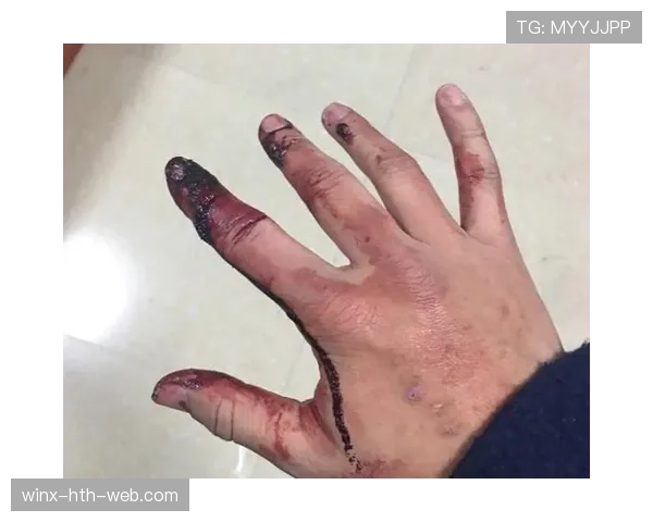 手部接触判定是什么规则？新手如何理解篮球中的合法与非法手部接触